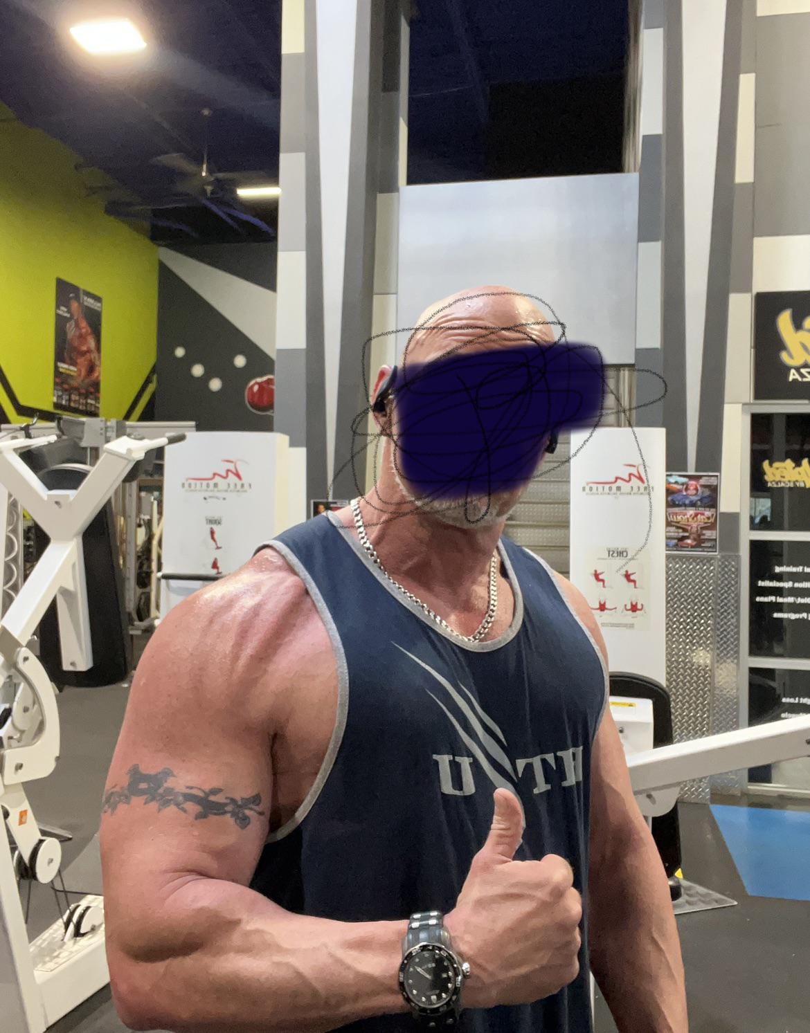 do you need testosterone the rest of your life after starting it? : rTestosterone