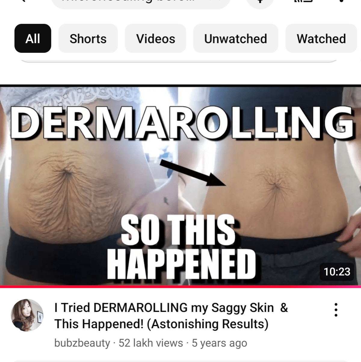 Flacidez Abdominal : rSkincare_Addiction