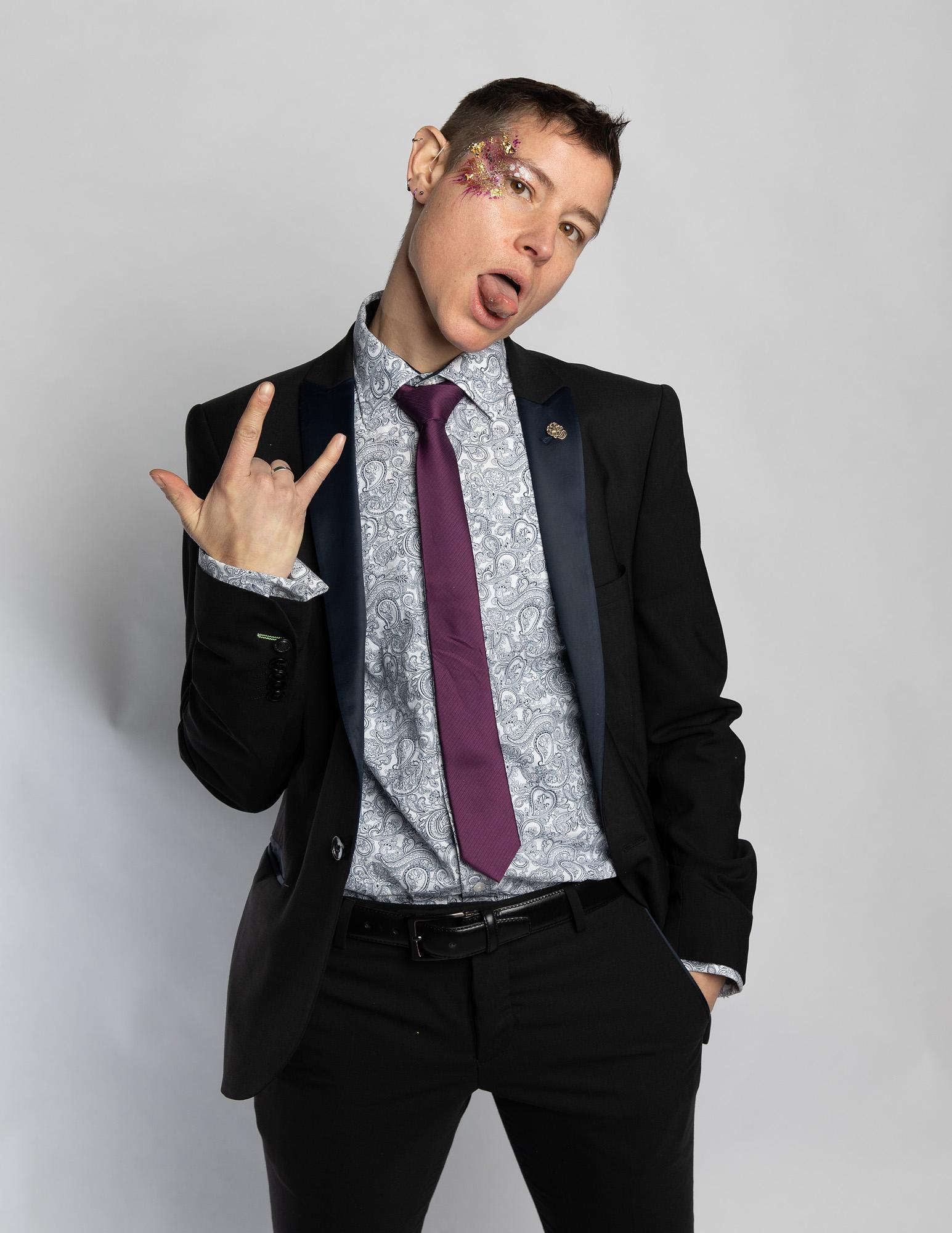 Rocking My Suit At The Glitter Themed Office Christmas Party After 9 Weeks On Low Dose T Ftm