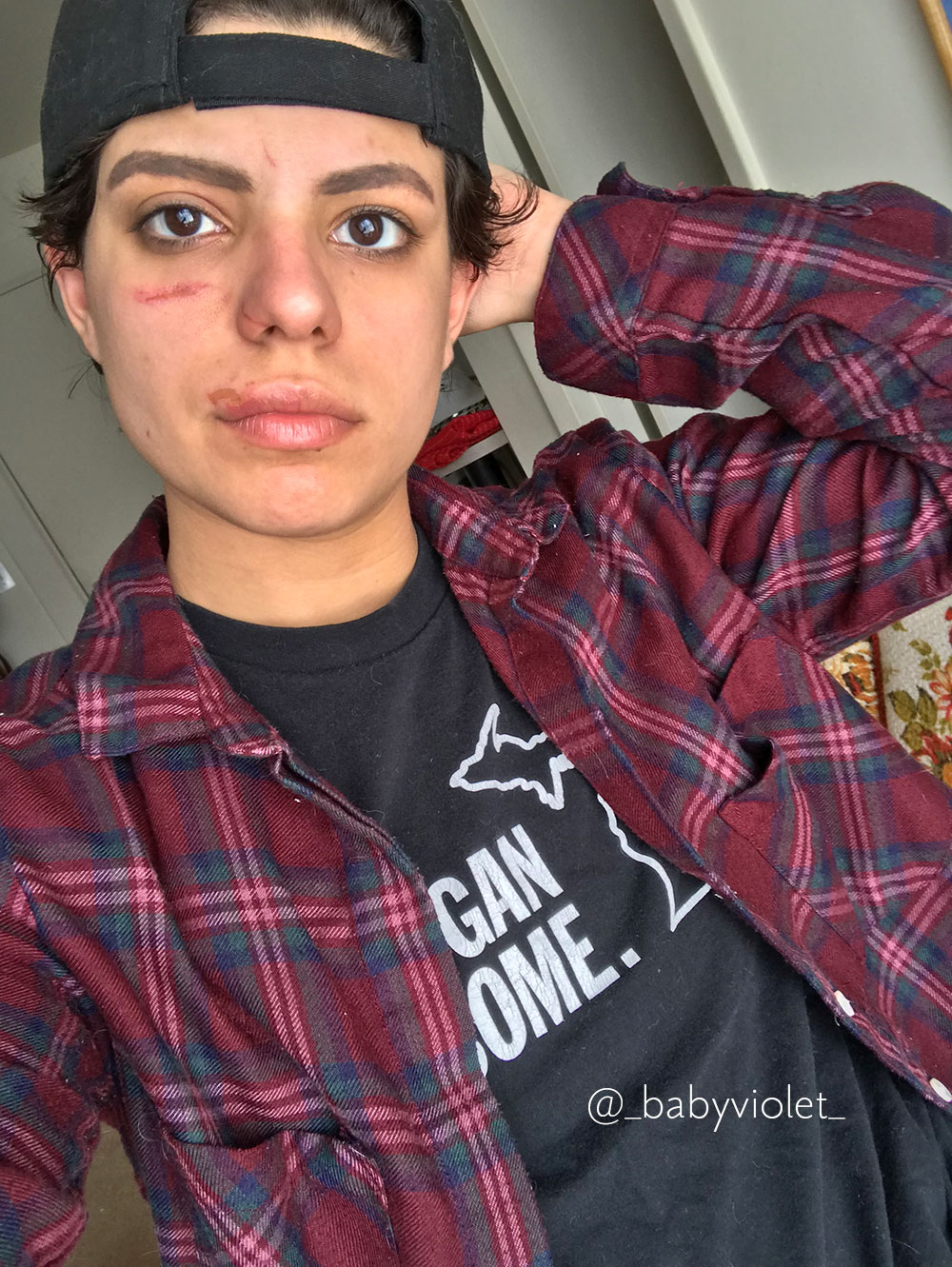 You should see the other guy, baby.
