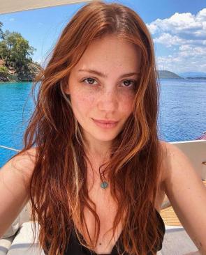 Freckled