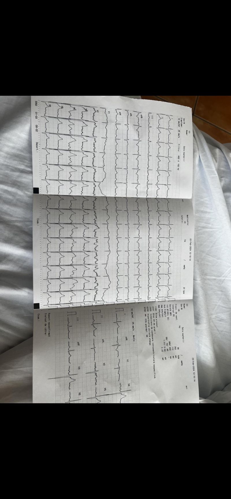 Abnormal Ecg R Readmyecg - Retina Light Illustrations for Desktop