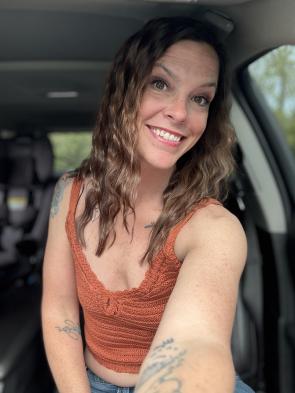 Freckles as far as the eye can see