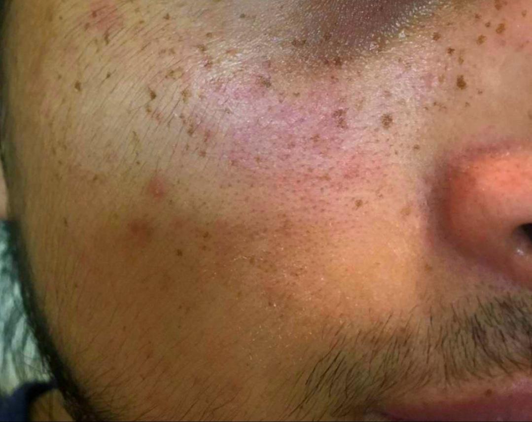 review my experiences with glow recipe avocado serum and aveeno calm restore cleanser rskincareaddiction on glow recipe avocado ceramide recovery serum reddit