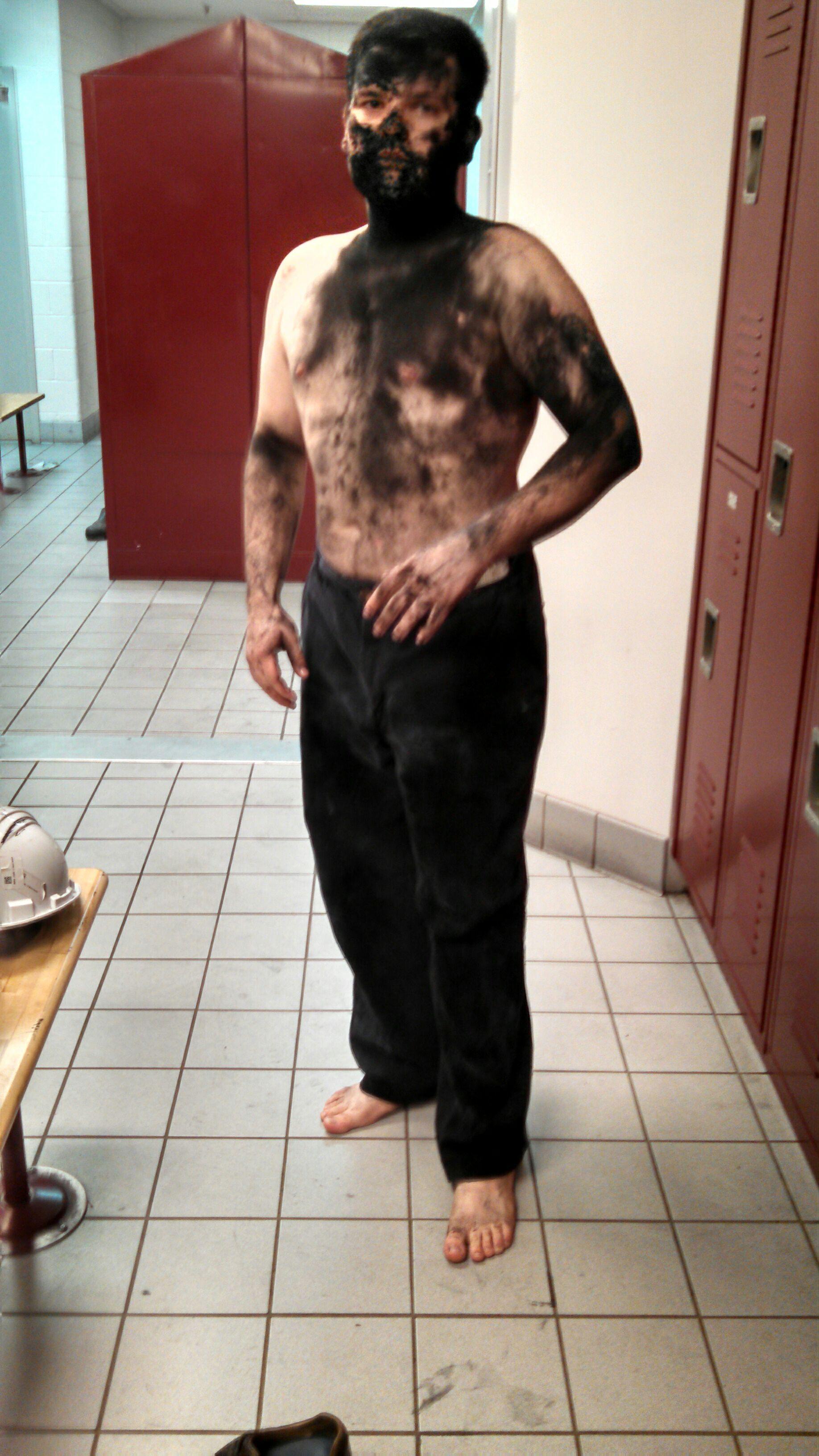 Got Cast Osha : Always wear your PPE! : OSHA