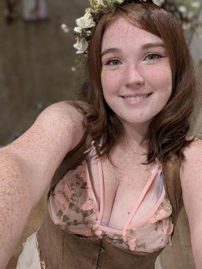 summer freckles are thriving!!!