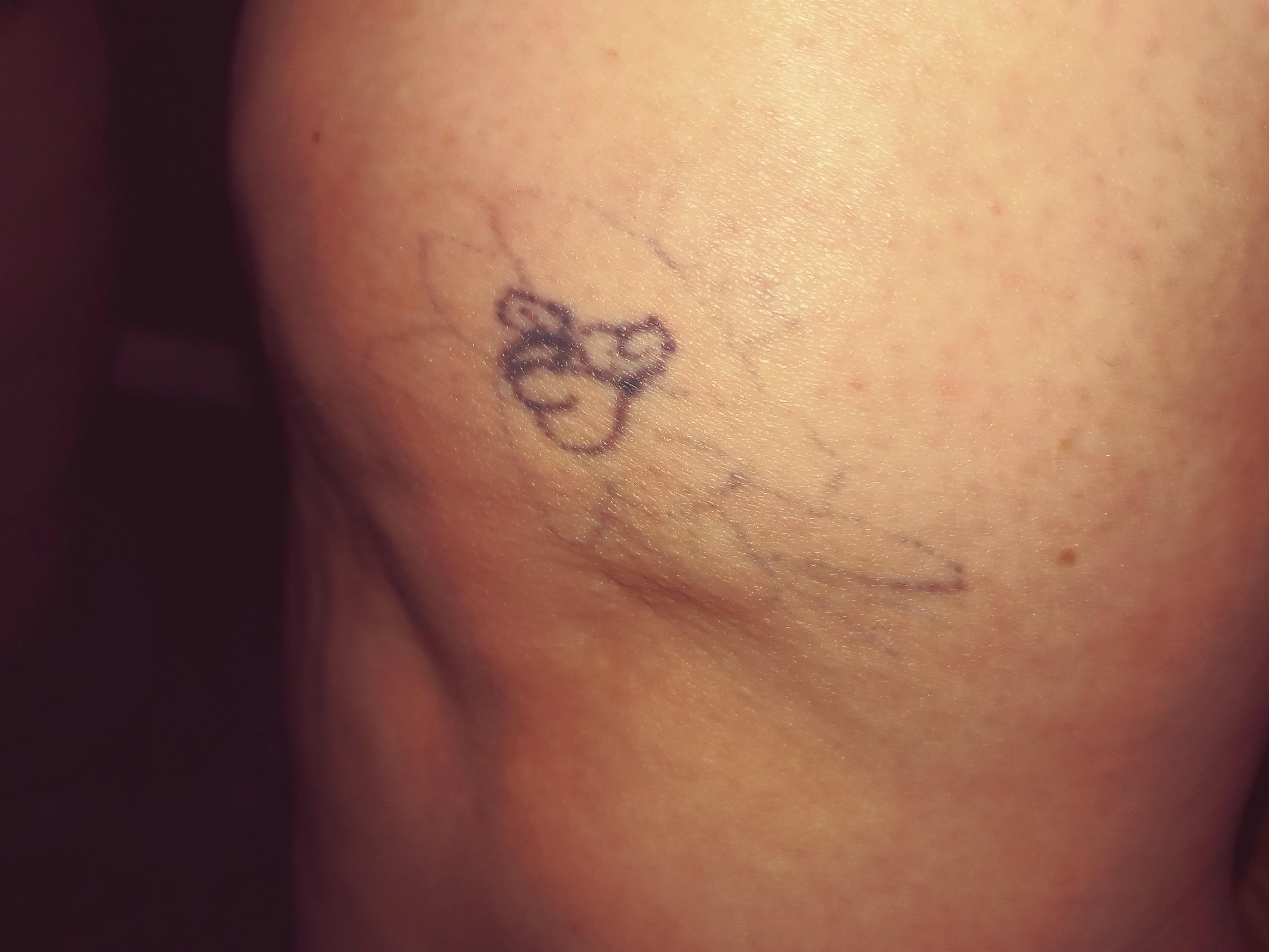 I Asked For A Rose, Instead I Got Balls, A Micropeen? And Blobs : R/Shittytattoos 3120_x_4160_jpg
