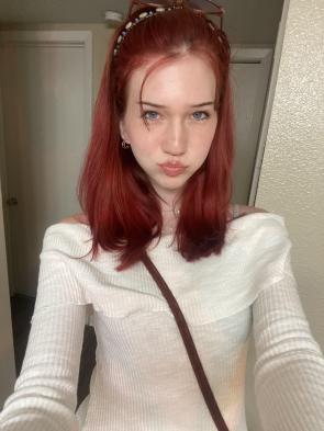 Freckles and red hair>>>>