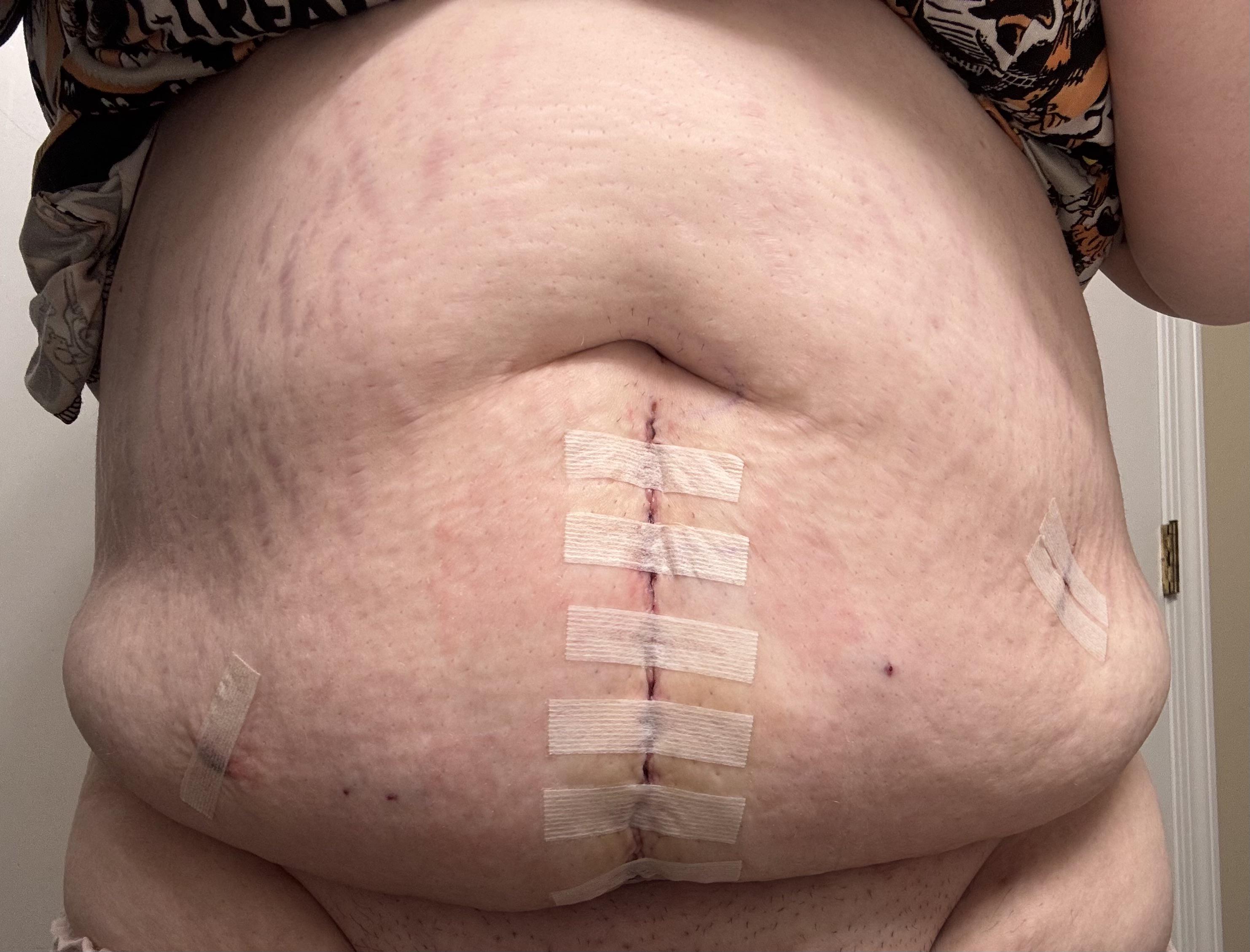 Clinomania Vontade de Dormir Excessiva