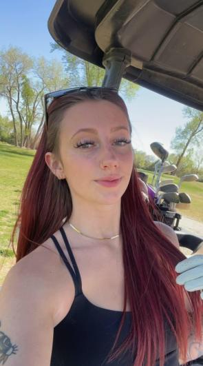 Freckled under the sun