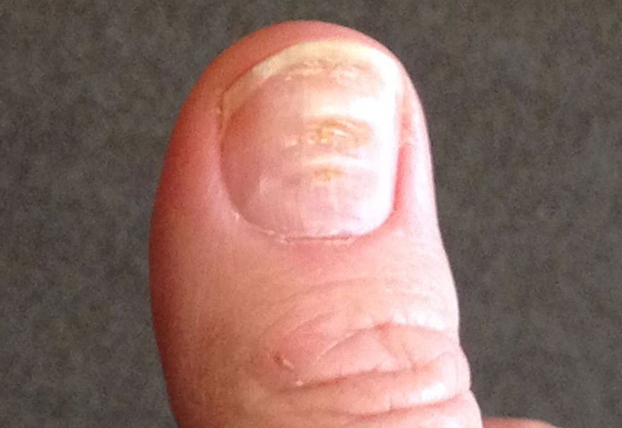 Uzm Dr Hakan Buzoglu Dermatoloji Uzmani