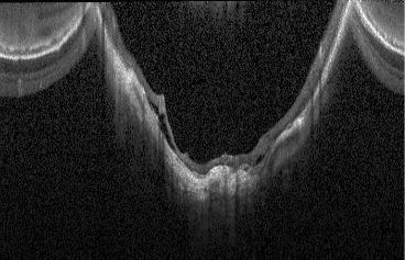 Github Halirutan Colordeconvolution - Classic Minimal Art - Mobile