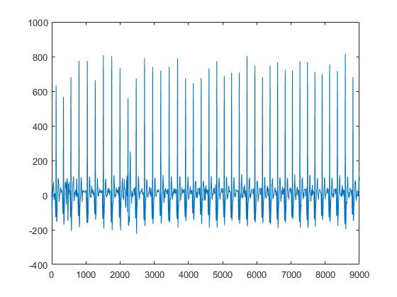 Matlab Wavelet Transform 3d Plot For Cop Signal Processing Stack - Amazing 4K Abstract Patterns | Free Download