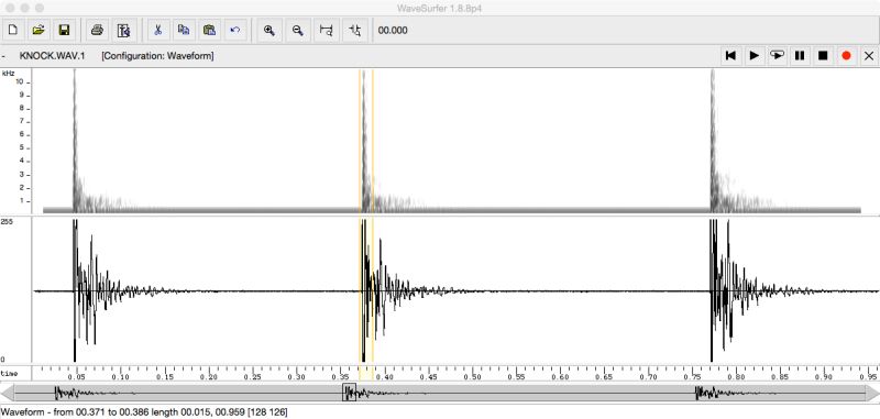 Matlab Clap Sound Detection Stack Overflow - Creative High Resolution Dark Designs | Free Download