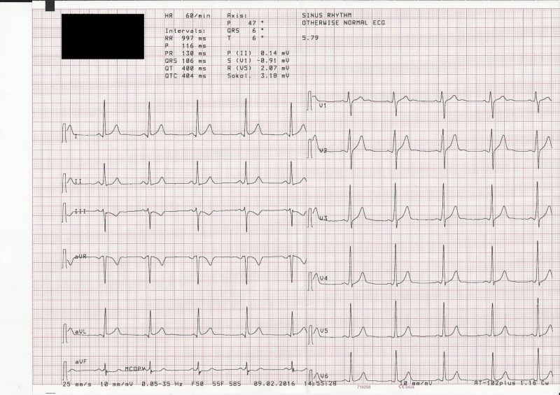 Interpretacin De Ecg Docsity - Mobile Landscape Photos for Desktop