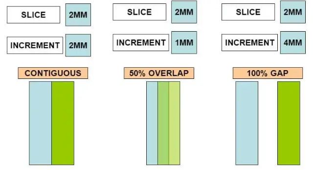 Python Dicom Pixel Dimension Stack Overflow - Amazing HD Landscape Images | Free Download