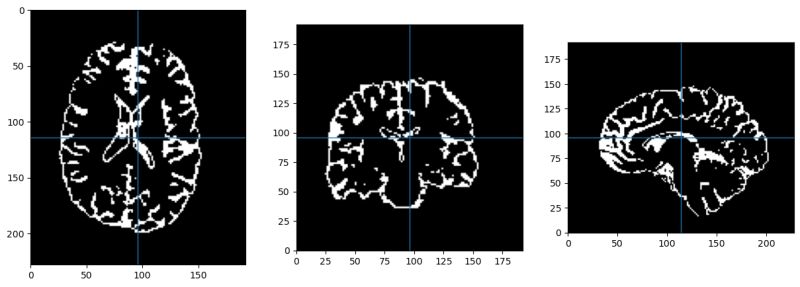 Python Simpleitk Filtering With Sitk Connectedthresholdimagefilter - Elegant Colorful Art - Full HD