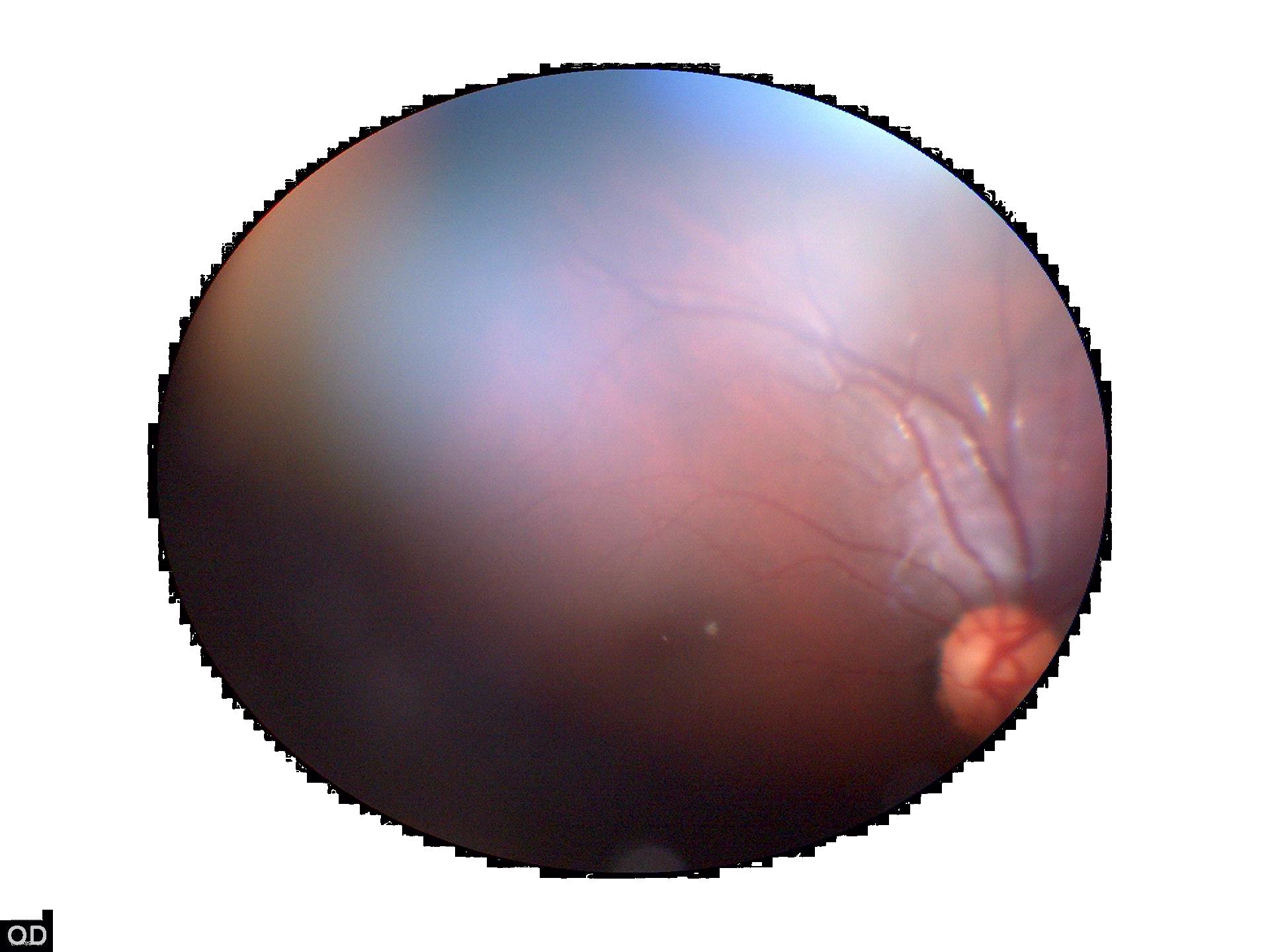 Go to file > export > export as · step 3 . Convert Jpg To Png With Background Transparency Stack Overflow