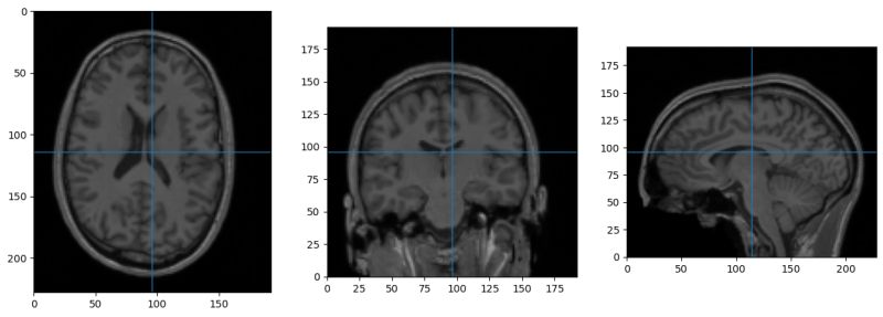 Image Compressing While Using Sitk Writeimage Issue 328 - Download Classic Mountain Art | HD