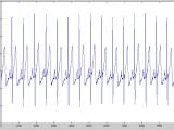 Matlab How To Filter A Discrete Signal Signal Processing Stack Exchange
