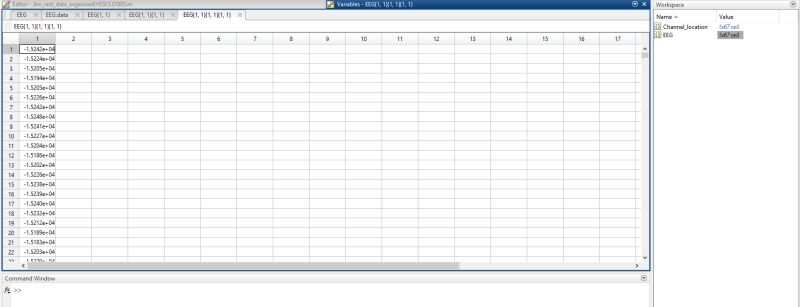 What S Actually Inside These Eeg Values Signal Processing Stack Exchange - Light Wallpaper Collection - Full HD Quality