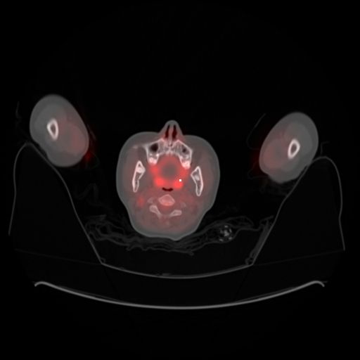 C How To Fit Two Images Into One Image Stack Overflow - Space Patterns - Classic High Resolution Collection