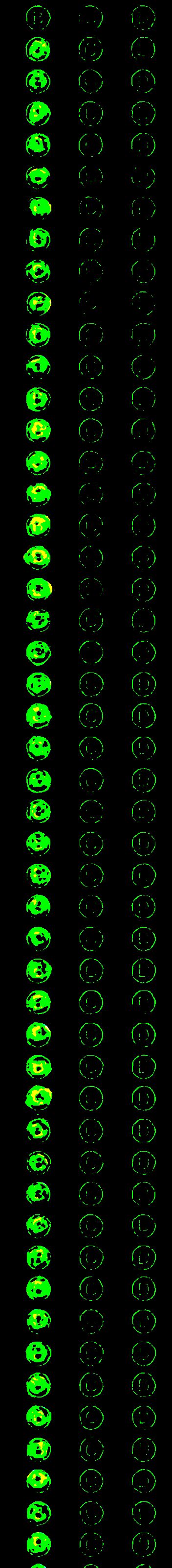 Image Processing Opencv Omr Sheet Detect Marked Answers In Python - Download Creative Dark Pattern | Full HD