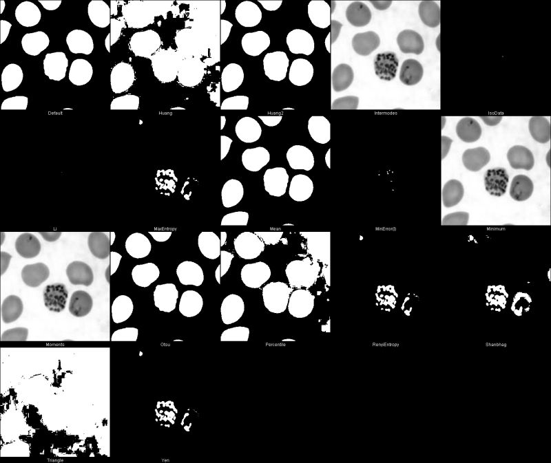 Matlab Red Blood Cell Color Image Segmentation Signal Processing - Light Illustrations - Perfect Retina Collection