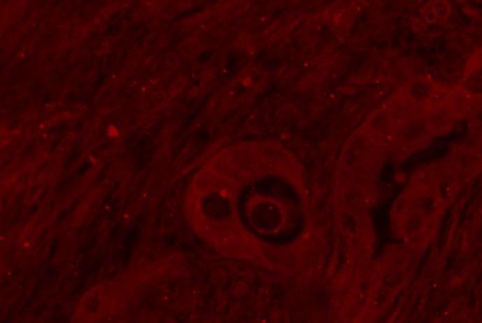 Analyze Particles Threshold Has Not Been Set Error Image Analysis - Premium Geometric Texture Gallery - Mobile