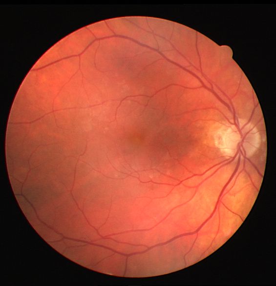 Matlab Comparing Images Pixel By Pixel Stack Overflow - Beautiful Ultra HD Colorful Textures | Free Download