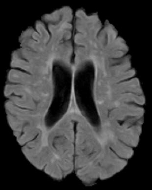 Pytorch Mri Mri Python Csdn - Premium Light Texture Gallery - Ultra HD