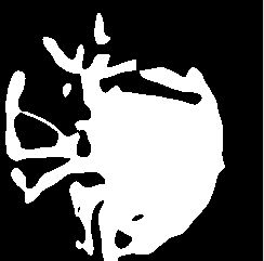 Image How To Segment Blood Vessels Python Opencv Stack Overflow - Best Dark Patterns in Desktop