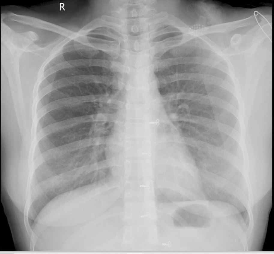 The cxrb spectral properties, flux and . Python Crop X Ray Image To Remove Black Background Stack Overflow