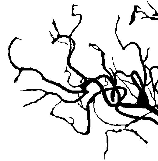 Removing Parallel Edges From Binary Image Signal Processing Stack - Amazing Mountain Design - Retina