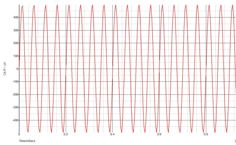 Power Amplifier Ce Ce Class Ab Amp Design Help Electrical - Amazing Minimal Wallpaper - Mobile