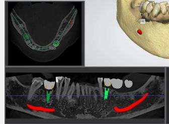 Quick Tip Flatten A Sculpted Surface - Best Ocean Illustrations in Ultra HD