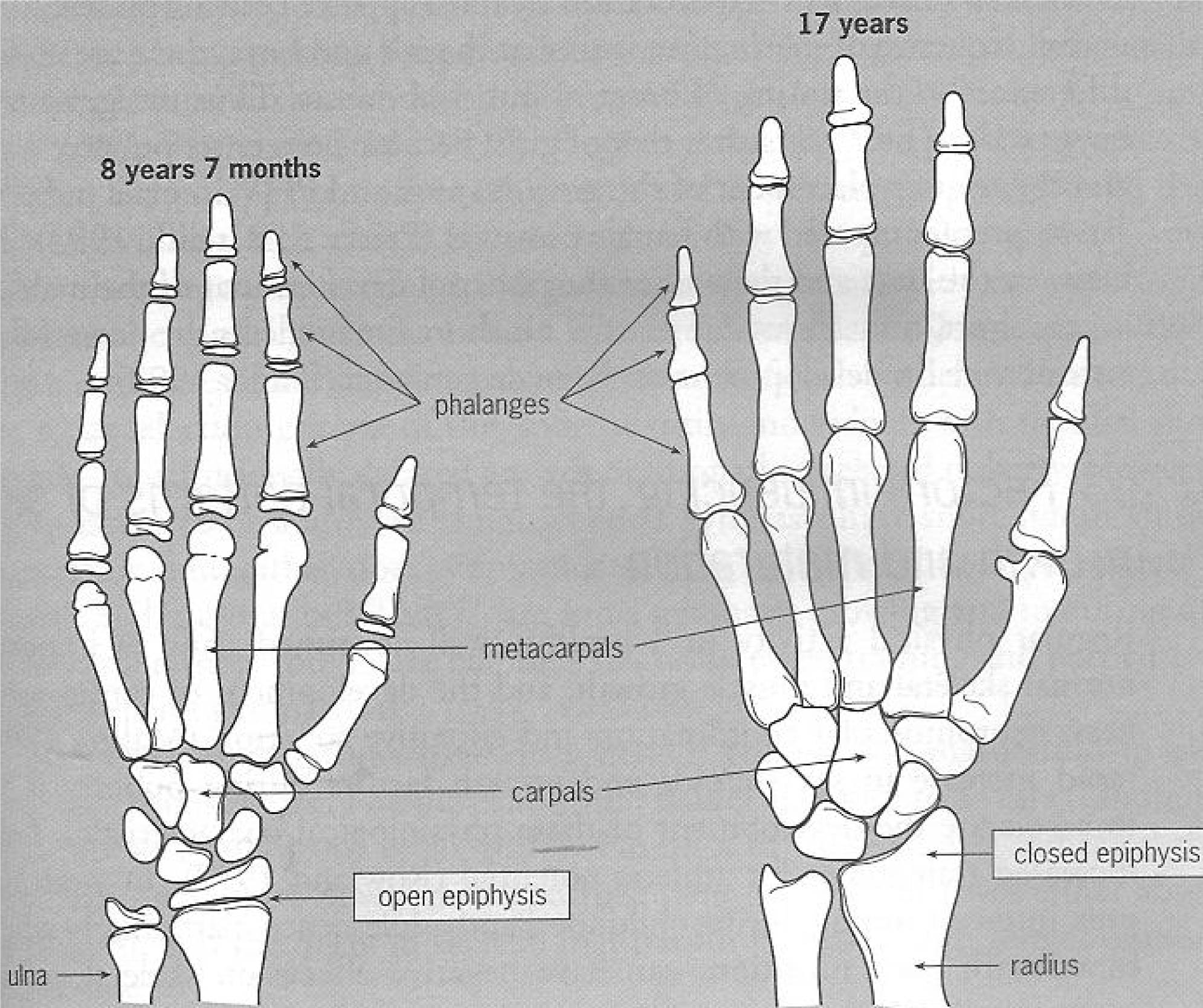 Once he is completely grown, the growth plate completely . Health What Are Growth Plates In Dogs Pets Stack Exchange