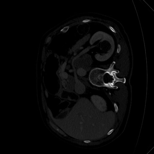 Image Orientation Changes When Converting To Numpy Array Issue 113 - Incredible HD Minimal Pictures | Free Download