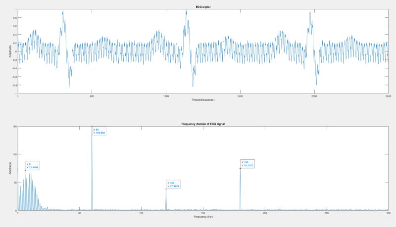 Noise Signal Processing Research Idea Signal Processing Stack Exchange - Best Nature Pictures in High Resolution