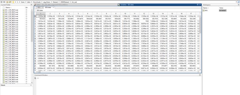 What S Actually Inside These Eeg Values Signal Processing Stack Exchange - Minimal Photo Collection - Ultra HD Quality