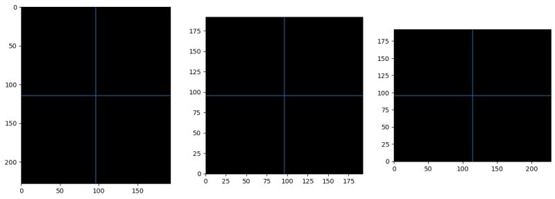 Python Simpleitk Filtering With Sitk Connectedthresholdimagefilter - Best Vintage Patterns in Mobile