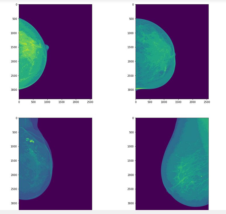Python Cv2 Imwrite Does Not Write Correct Pixel Values Stack Overflow - City Illustrations - Beautiful Retina Collection