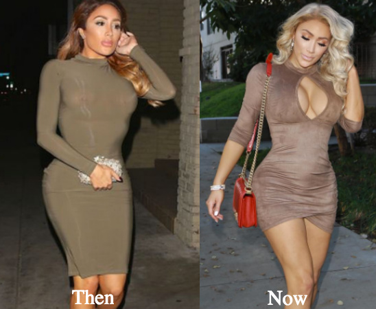 picture Surgery Nikki From Love And Hip Hop nikki mudarris nikkibaby before plastic surgery and after does she look better latest plastic surgery gossip and news plastic surgery tips and advice