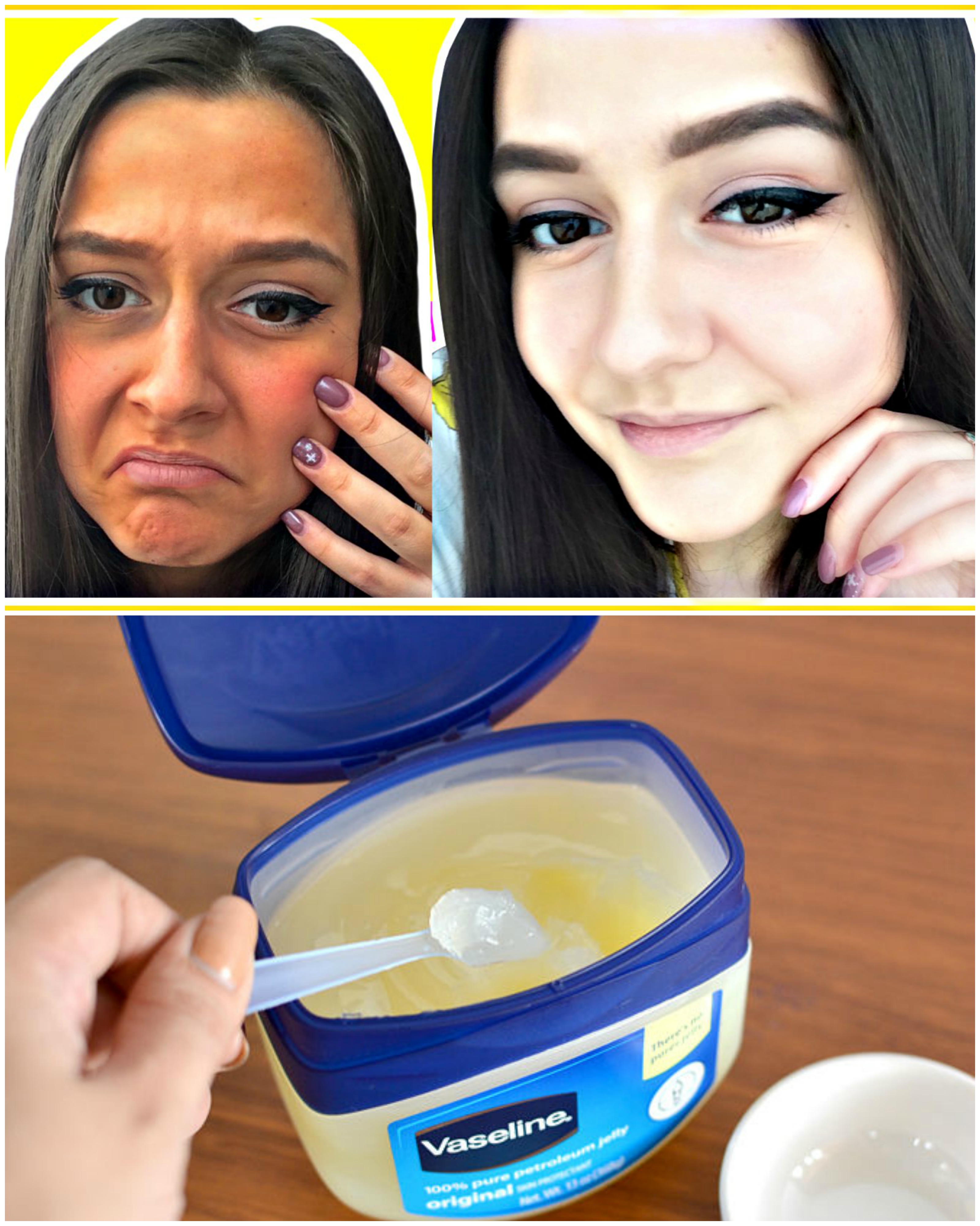 pics Cream Vaseline How To Remove Dark Circles my simple remedies
