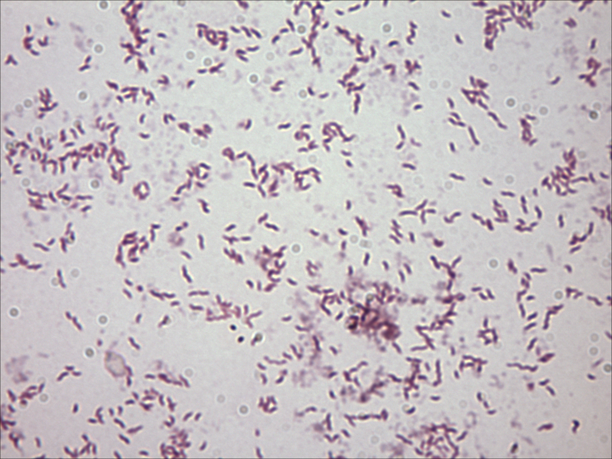 pics Campylobacter Coli Gram Stain https www stepwards com page id 7207