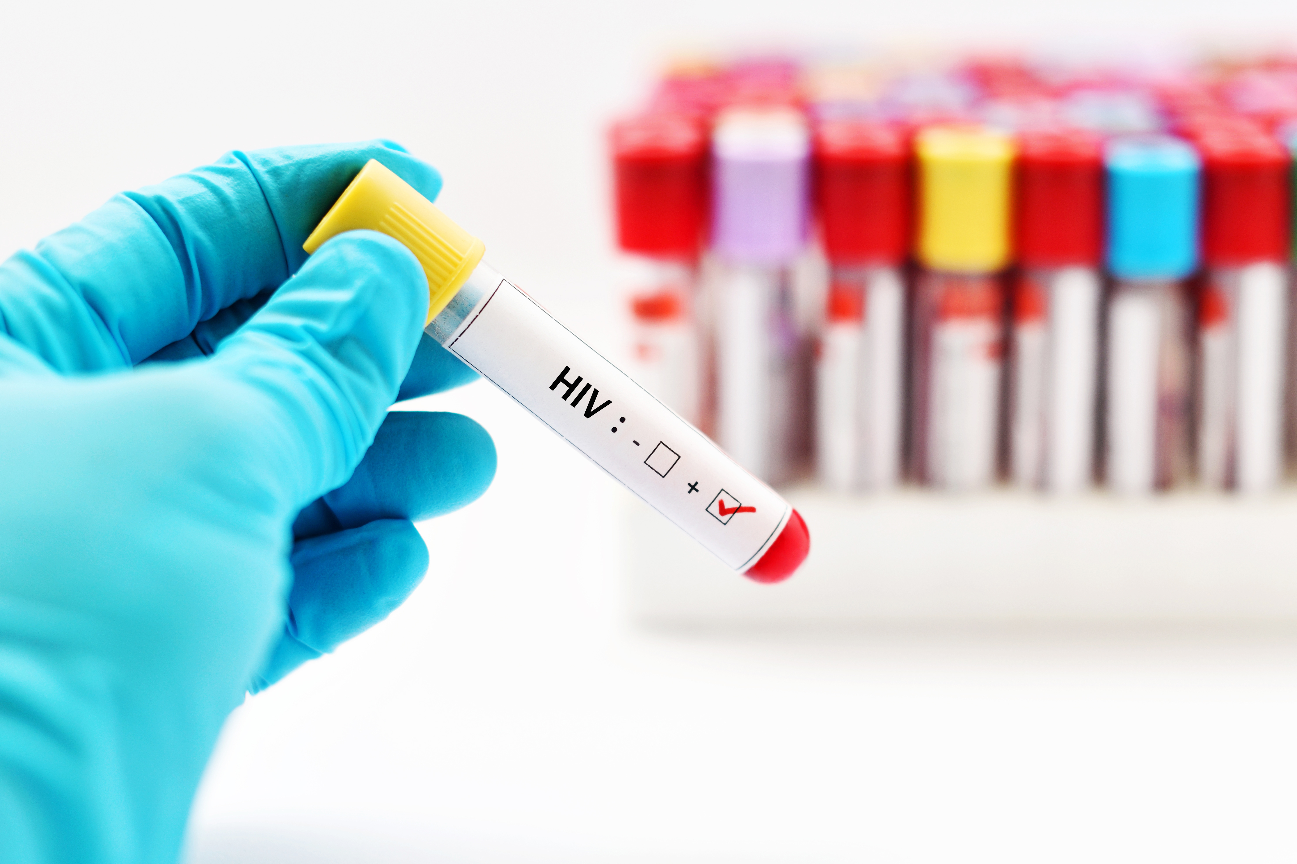 Hiv Aids The Other U S Mexican Border Crisis 