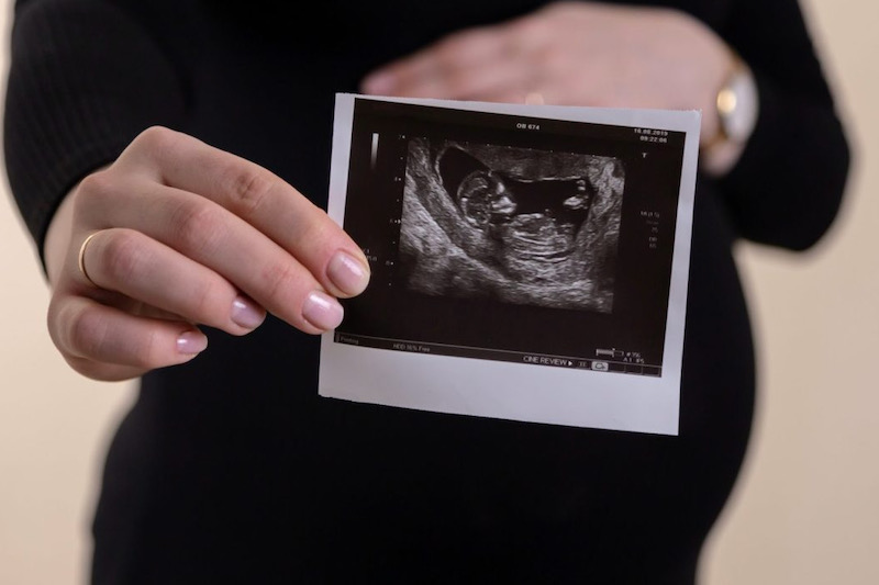 أمنستي تستقبل نقاش الإجهاض.. وقف للسِّرية واجتهاد ديني ورجولة إيجابية