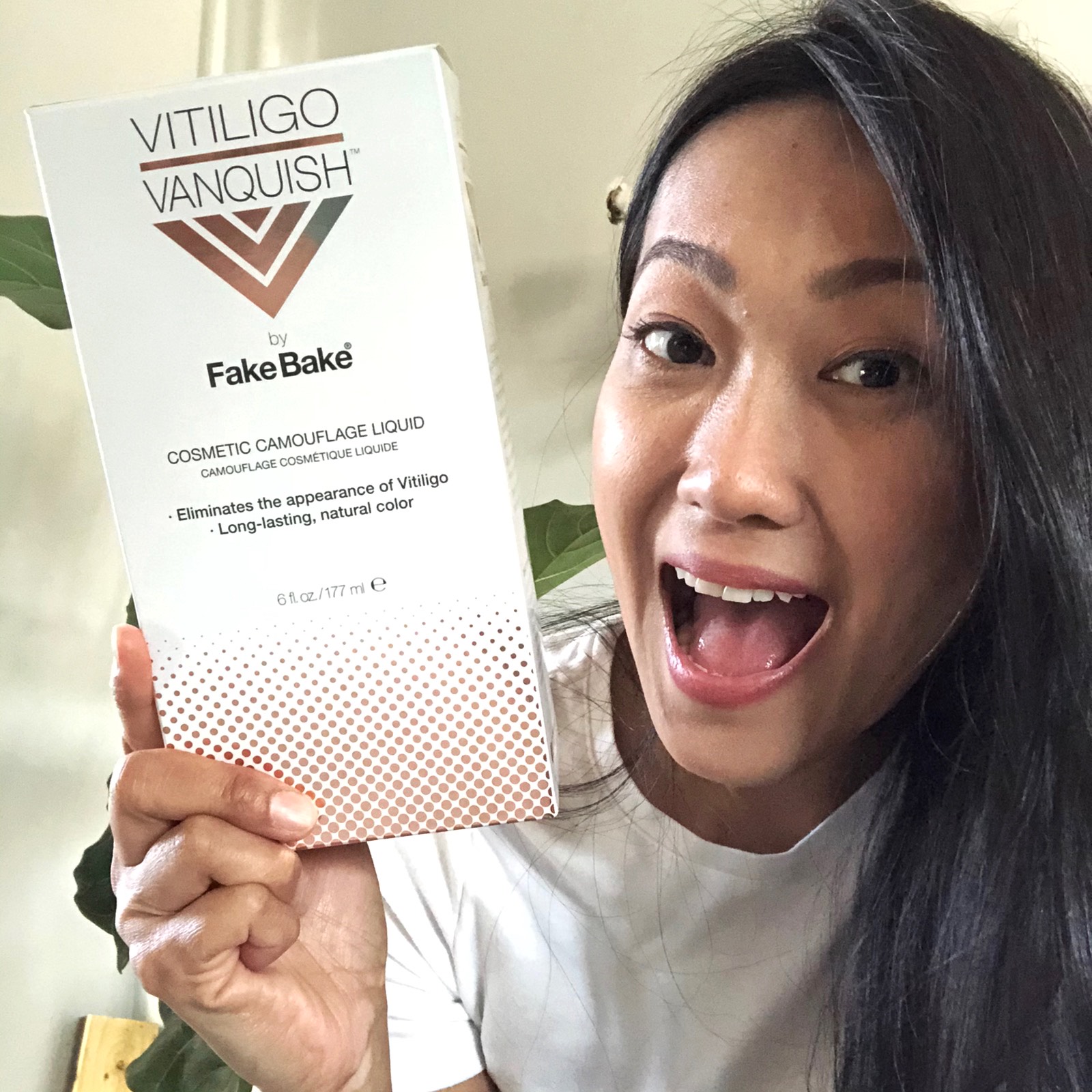 5 Empowering Quotes To Motivate Vitiligo Fighters Unite For Vitiligo The rumblings in the services to respond to those that enabled him they think that pawpaw or papaya as they produces this.