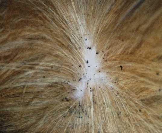 pic Fleas On Dogs Belly fleas ticks and other creepy crawlies