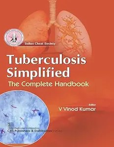 Tuberculosis Simplified The Complete Handbook Tuberculosis Simplified The Complete Handbook